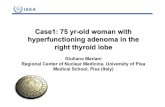 Case1: 75 yr -old woman with hyperfunctioning adenoma in ... · Case1: 75 yr -old woman with hyperfunctioning adenoma in the right thyroid lobe GiulianoMariani RegionalCenter ofNuclearMedicine,
