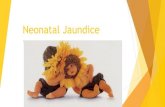 Neonatal Jaundice - pediatrie.usmf.md · Neonatal Jaundice - definition Neonatal jaundice is manifested by yellow coloring of the skin, of sclera and mucousa caused by accumulation