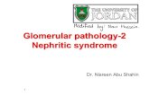 Modified Glomerular pathology-2 Nephritic syndrome€¦ · 1- Membranoproliferative Glomerulonephritis (MPGN) Abnormal proliferation of glomerular cells Usually nephritic syndrome;