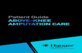 Above-Knee Amputation Care | Patient Guide€¦ · Patient Guide. ABOVE-KNEE AMPUTATION CARE. To learn more, visit . HangerClinic.com. Hanger Clinic ® is committed to helping you