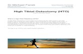 New High Tibial Osteotomy (HTO) - Dr Michael Facek · 2019. 8. 29. · An HTO involves precisely cutting the leg bone (tibia) just below the knee joint, and re-aligning it. Once the