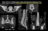 Patient de 60 ans; lombalgies banales, d'allure mécanique ...onclepaul.fr/wp-content/uploads/2011/07/myspe.pdf · les complications de la splénomégalie myéloïde sont de plusieurs