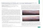The Gulf Journal of Dermatology and venereology · linear lichen planus, linear Darier's disease(9) and unilateral keratosis follicularis(l()). Although differentiation could be reached