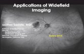 Applications of Widefield Imaging894acfa90051d7a2a27e-8978d0c3c4c8cb744d658542db70335f.r59.… · 2014. 1. 6. · LP HM Diagnosis: Pathologic myopia with deep staphyloma (a xial length: