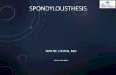 Spondylolisthesis - Pronto Marketing...Spondylolisthesis does not exist at birth Spondylolysis 4.4% at age 6, 6% in adult Development of pars defect does not cause pain in most patients