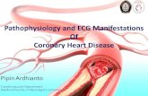 Pathophysiology and ECG Manifestations Of Coronary Heart ......A. ASPIRIN dan ANTI KOAGULAN Aspirin diberikan secara rutin dan terus menerus pada pasien pasca serangan jantung. Bersama