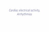 Cardiac electrical activity, Arrhythmias · Left axis deviation: ≥ -30°(i.e., lead II is mostly negative) •Left ventrucular hypertrophy •Left Anterior Fascicular Block (LAFB):