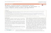 Bulbar conjunctival metastasis from mucoepidermoid carcinoma of parotid… · 2017. 8. 26. · CASE REPORT Open Access Bulbar conjunctival metastasis from mucoepidermoid carcinoma