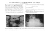 The Superior Vena Cava: Conventional Projections...superior vena cava. Radiology 1970;95:3 17-8 3. Drasin E, Sayre RW, Castellino RA: Non-dilated superior vena cava presenting as a