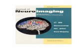 MRI findings - Vortala · 2017. 11. 30. · Journal of Volume 8 / Number 2 Apr i/ imaging Official Journal Of the American Society of Neuroimaging CT MRI Neurosonology PET SPECT Brain