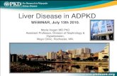 Liver Disease in ADPKD - Pkdietprotein of TOR (RAPTOR), and inhibits mTOR kinase activity. • Inhibition of mTOR: downregulation of CDK complexes and p27 (Kip1) accumulation; blocks