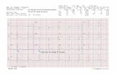 Q waves more worrisome given Hx of CP and murmur - Cardiac … · 2017. 7. 16. · Hx of CP and murmur ECG-104. 16B32819 , 228 Female , Caucasian Abnormal Q—Waves : Inf Consistent
