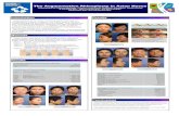 The Augmentation Rhinoplasty in Asian Noses · for rhinoplasty and suggest the most appropriate technique for each type. Type IV Type I Origins of septal reconstruction Previous septal