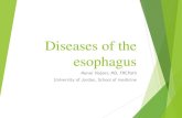 Diseases of the esophagus - JU Medicine · 1/1/2019  · Food impaction and dysphagia in adults Feeding intolerance or GERD-like symptoms in children Endoscopy: Rings in the upper