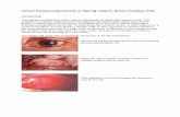 Vernal Keratoconjunctivitis or Spring catarrh, Simon ... conjunctivitis.pdf · Vernal Keratoconjunctivitis or Spring catarrh, Simon Franken PhD. Introduction. This allergic condition