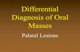 Differential Diagnosis of Oral Masses · 2020. 10. 2. · Palatal Abscess. Torus Palatinus • Onset during adulthood • Females>Males • Quite variable in size • Tendency for