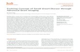 Small Vessel Disease II Evolving Concept of Small Vessel Disease … · 2015. 6. 13. · The epidemiology and risk factors of silent cerebral infarcts ... that small subcortical infarcts