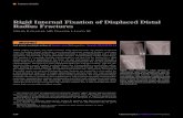 Rigid Internal Fixation of Displaced Distal Radius Fracturesm3.wyanokecdn.com/92469c8eaefdd04b87d723dad3c95edf.pdf · 2014. 5. 16. · The implant is a partially flexible intramedullary