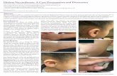 Hydroa Vacciniforme: A Case Presentation and Discussion · 2018. 6. 13. · of the photodermatosis family, which includes polymorphous light eruption (PMLE) and actinic prurigo.1,7