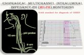 Esophageal Multichannel Intraluminal Impedance-pH (MII-PH ... · Discovered by Georg Ohm around 1800 Georg Simon Ohm 1789-1854 Esophageal Multichannel Intraluminal Impedance-pH (MII-PH)