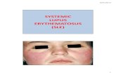 SYSTEMIC LUPUS ERYTHEMATOSUS (SLE)...Manifestations of SLE • Fever • Rashes • Arthritis • Fatigue • Weight loss • Lung – Pleurisy, pneumonia • Heart – Pericarditis,