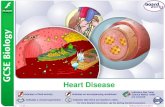 Heart Disease - todhigh.comtodhigh.com/.../WordPress/wp-content/uploads/2018/03/Heart-Disea… · Preventing deaths from heart disease Heart disease is caused by: lifestyle choices