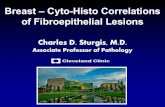 Breast –Cyto-Histo Correlations of Fibroepithelial Lesions...4.8% of benign breast tumors (WHO, 2012, Chapter 11). Term first applied by Arrigoni et al to breast lesions in 1971.
