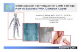 Endovascular Techniques for Limb Salvage: How to Succeed ......Intravascular Lithotripsy (IVL) SCRIPPS CLINIC IVL THERAPY SCRIPPS CLINIC Successful Treatment of CLI Patients: It Takes