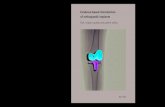 Evidence based introduction of orthopaedic implants · 2014. 1. 5. · Evidence based introduction of orthopaedic implants RSA, implant quality and patient safety Proefschrift ter