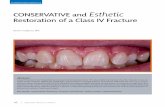 American Academy of Cosmetic Dentistry ......Journal of Cosmetic Dentistry 17The creation of a smooth, harmonious guidance pattern, both in protrusive and lateral excursions, is crucial