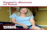 Paget’s disease of bone - Versus Arthritis...The parts of the body most likely to be affected are: • pelvis • spine • legs • skull • shoulders. The bones most commonly