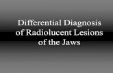 Differential Diagnosis of Radiolucent Lesions of the Jaws · 2020. 10. 2. · Thalassemia (Mediterranian Anemia) • Genetically inherited defect with mutations in the α or β peptide