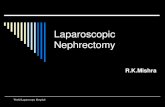Laparoscopic Nephrectomy - World Laparoscopy Hospital