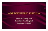 M&M Aortic enteric fistula - Department of Surgery at SUNY