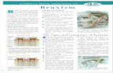 bruxisnm - Beachside Dental Clinic