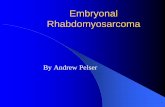 Embryonal Rhabdomyosarcoma - SUN