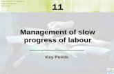 Management of slow progress of labour - WHO