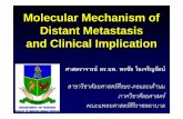 Molecular Mechanism of Distant Metastasis and Clinical ...