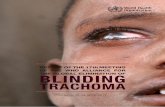 TRACHOMA - WHO | World Health Organization