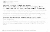 High Dose Rate (HDR) Intracavitary Brachytherapy for ...