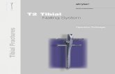 T2 Tibial - az621074.vo.msecnd.net