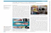 Salvage forearm to arm replantation - BMJ Case Reports