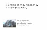 Bleeding in early pregnancy Ectopic pregnancy