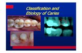 Classification and etiology of caries review