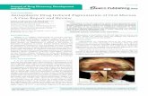 Antiepileptic Drug Induced Pigmentation of Oral Mucosa - A ...