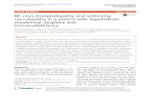 BK virus encephalopathy and sclerosing vasculopathy in a ...