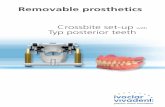 Crossbite set-up with Typ posterior teeth