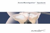 Arthrex - ZoneNavigator System