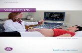 Voluson P6 - GE Ultrasound Europe