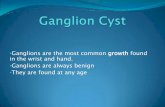 Ganglion Cyst presentation - Cedar Valley Hand Surgery